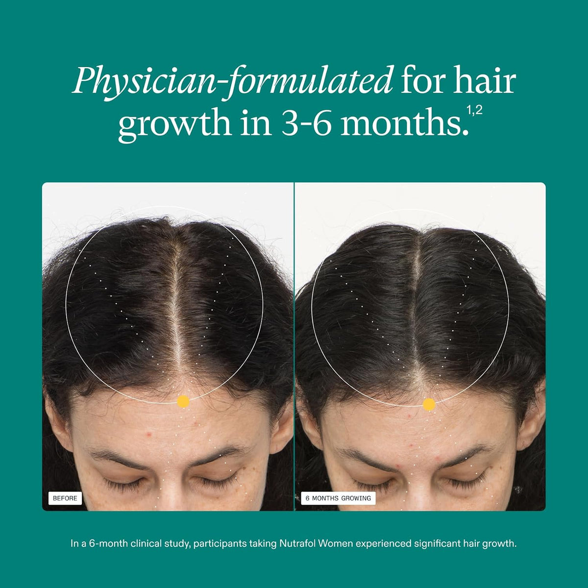 Nutrafol Women Hair Growth Supplements, Ages 18-44, 1-Month Pouch