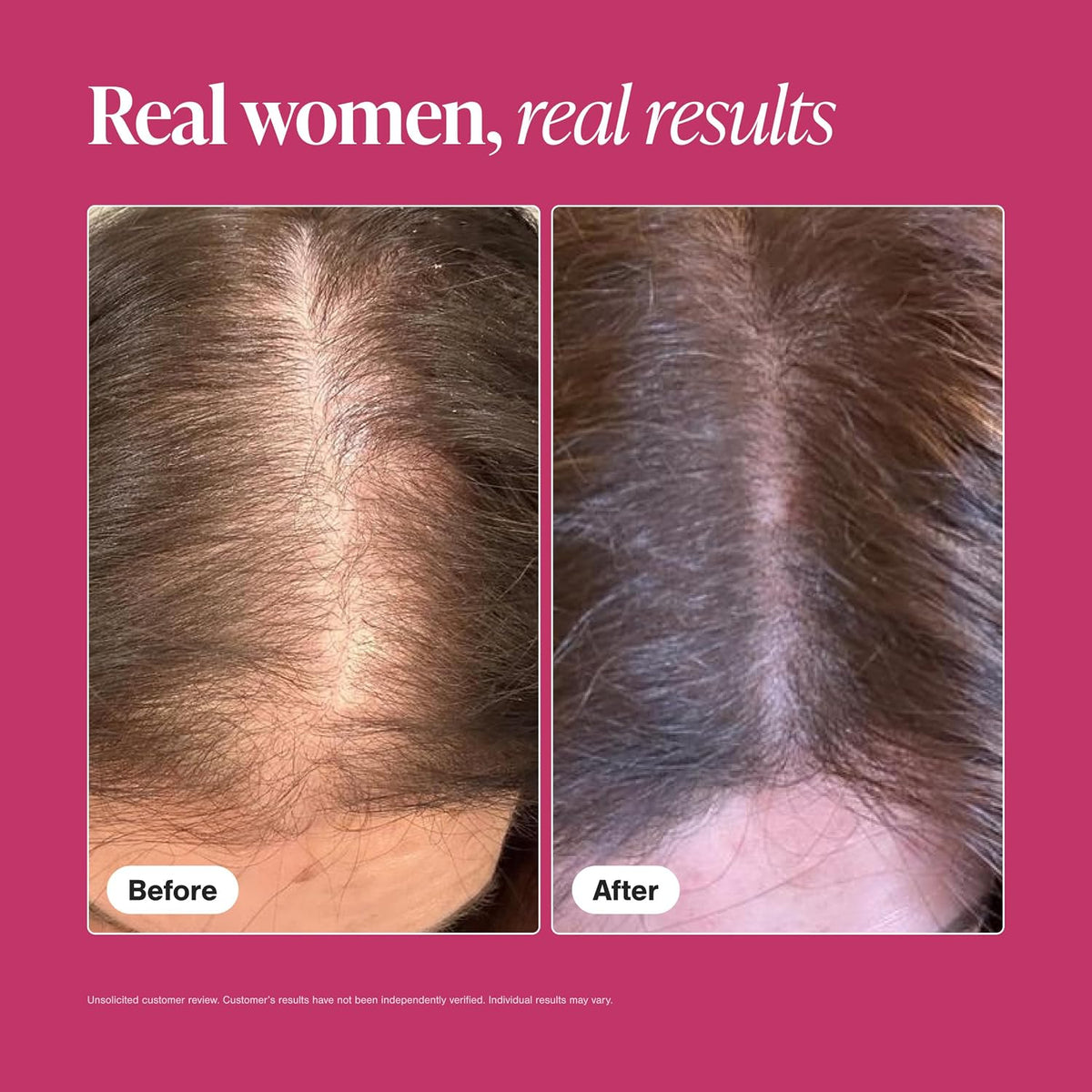 Viviscal Hair Growth Supplements for Women, 60 Tablets, 1 Month
