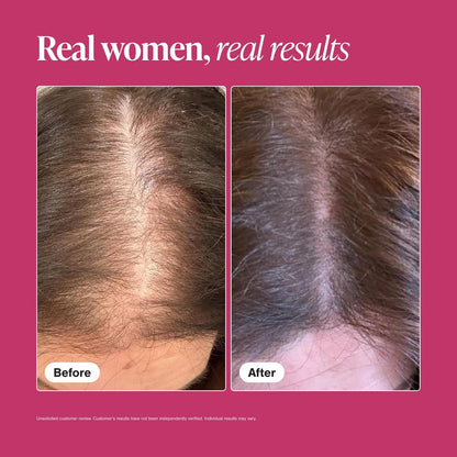 Viviscal Hair Growth Supplements for Women, 60 Tablets, 1 Month